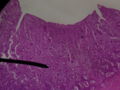 microscopic slide of the endometrium.