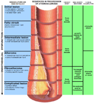 Endo dysfunction Athero.PNG