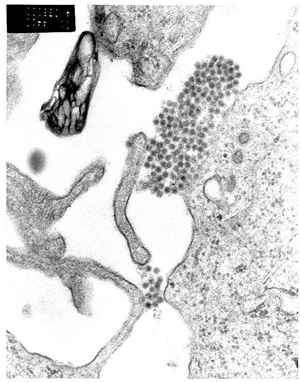A transmission electron microscopy image showing dengue virus