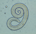 Trichinella larv1 DPDx.JPG