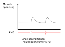 Muskulatur - Einzelzuckung.png