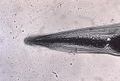 This micrograph reveals the cephalic alae in the head region of Enterobius vermicularis.