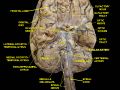 Cerebrum.Inferior view.Deep dissection