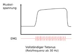 Muskulatur - vollstaendiger Tetanus.png