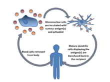 Blood cells are removed from the body, incubated with tumour antigen(s) and activated. Mature dendritic cells are then returned to the original cancer-bearing donor to induce an immune response.