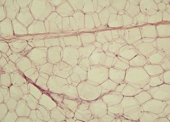 Yellow adipose tissue in paraffin section - lipids washed out.jpg