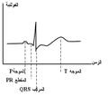 تصغير للنسخة بتاريخ 20:32، 2 يوليو 2010