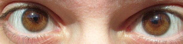 A light brown iris is most common in West Asia, Eastern Europe and the Americas.
