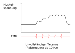 Muskulatur - unvollstaendiger Tetanus.png