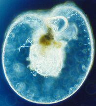 Noctiluca scintillans, a bioluminescent dinoflagellate[86]