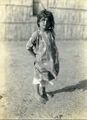 طفلة ارمينية في معسكر اللاجئين الارمن في بورسعيد مصر 1915