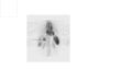 A nuclear medicine SPECT liver scan with technetium-99m labeled autologous red blood cells. A focus of high uptake (arrow) in the liver is consistent with a hemangioma.