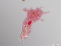 Amoeba with ingested diatoms