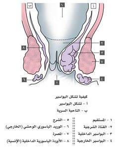 كيفية تكون البواسير.jpg