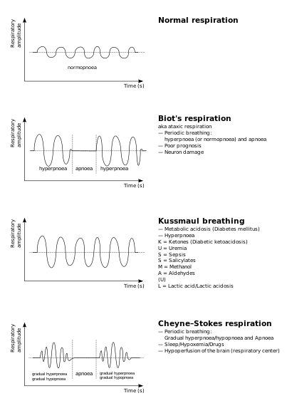 Breathing abnormalities.svg