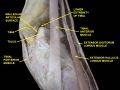 Dorsum of Foot. Ankle joint. Deep dissection