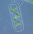 Single spirogyra cell