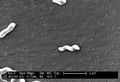 Scanning electron micrograph depicting a number of Campylobacter jejuni bacteria.