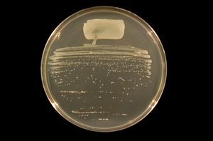 Rhizobium tropici strain BR816 on TY agar.JPG