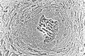 Light micrograph of undecalcified tissue displaying osteoblasts actively synthesizing rudimentary bone tissue (center).