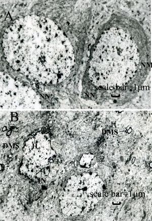 Two black and white photos; one shows dark, fairly regular rings on a lighter background, and the other shows irregular, smaller, and not as dark clusters.