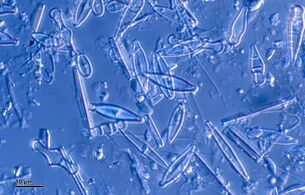 Diatoms are one of the most common types of phytoplankton.