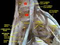 Lumbar and sacral plexus. Deep dissection.Anterior view.
