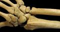 Right Human Posterior Distal Radius, Ulna, Carpals