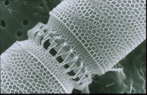 Linked diatoms