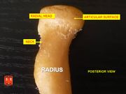 الكعبرة، radial head - posterior view